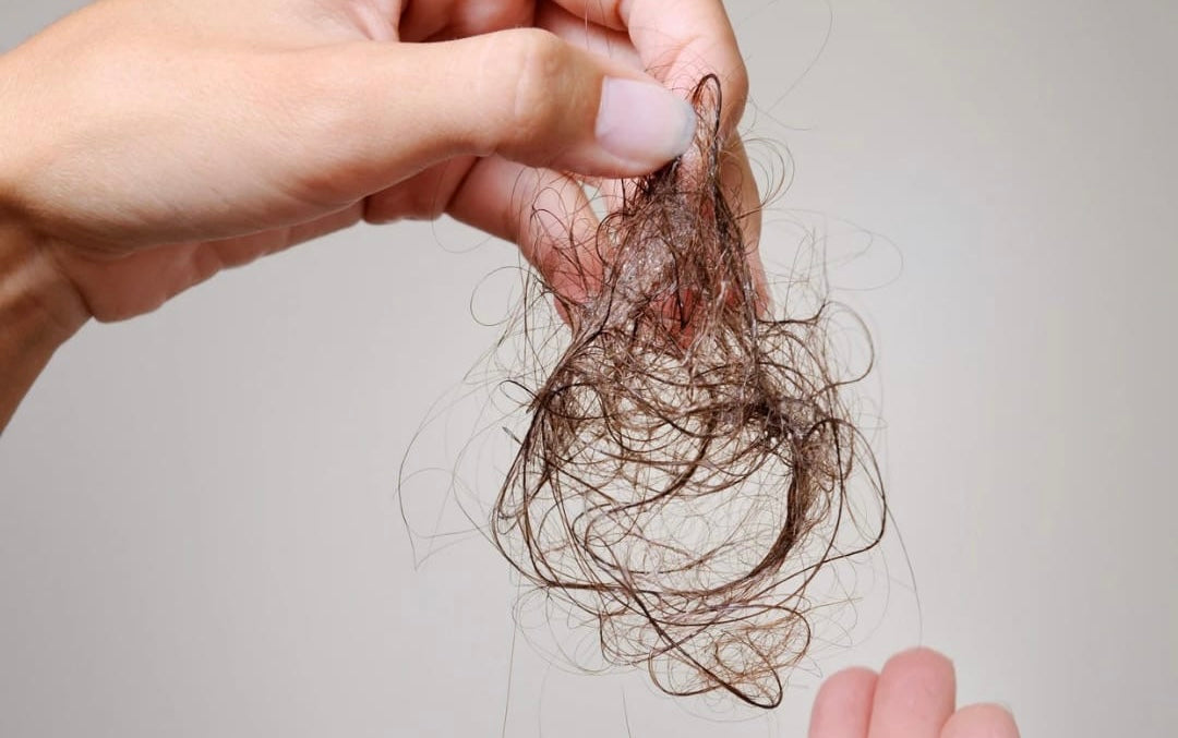 Haarausfall nach OP