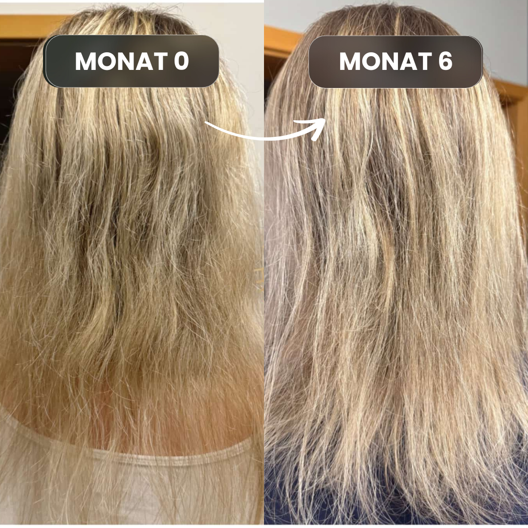 Growfine® Conditioner