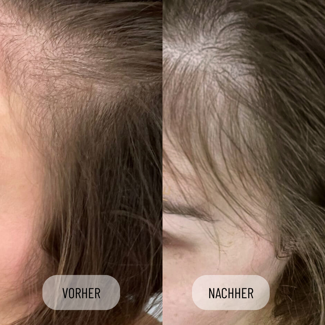 Growfine® Tonikum