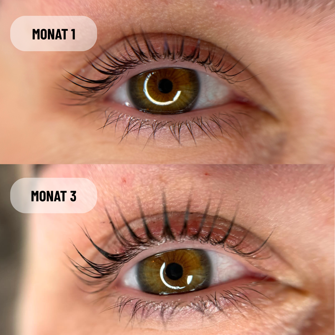 Growfine® Wimpern- & Augenbrauenserum