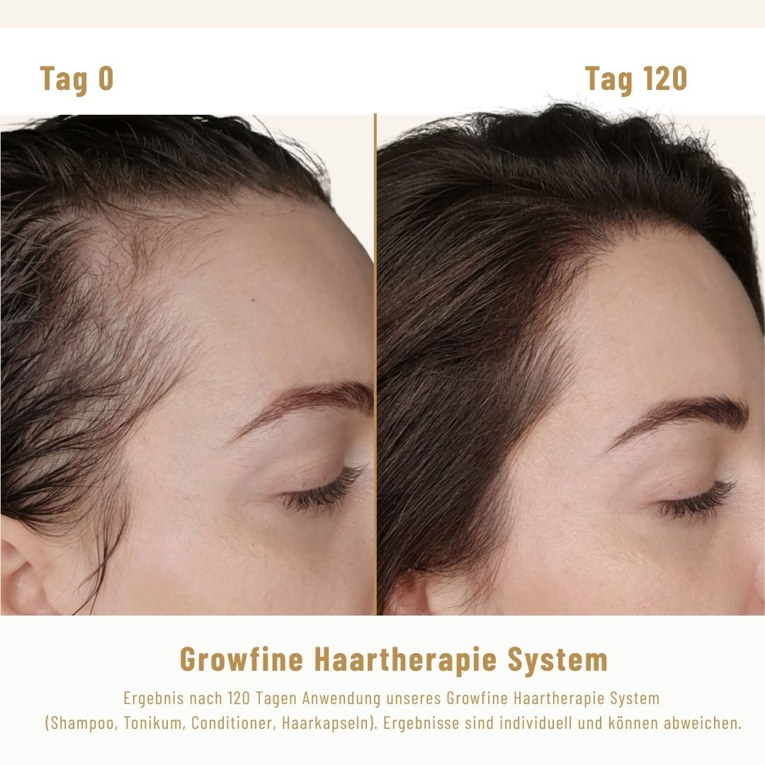 Growfine Haartherapie© Premium-Set (Innen & Außen)