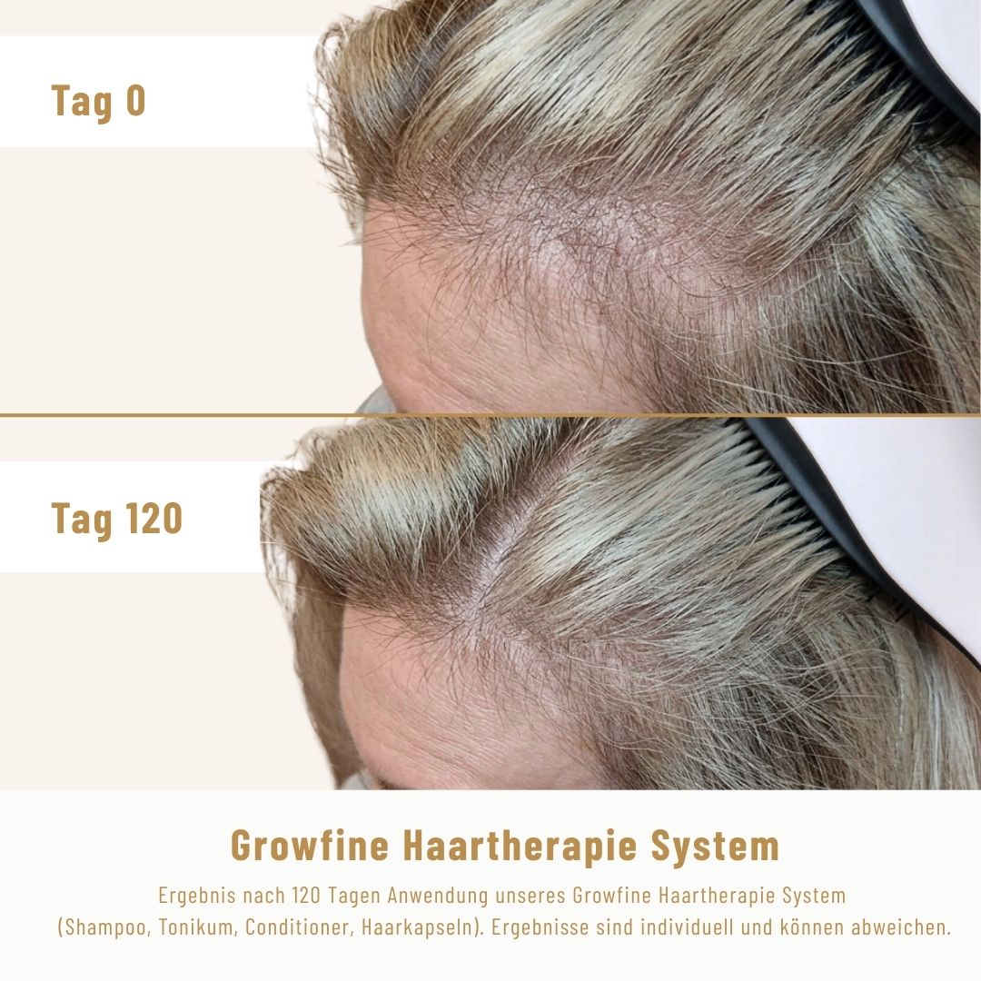 Haarkapseln - Nährstoffkomplex für stärkeres Wachstum