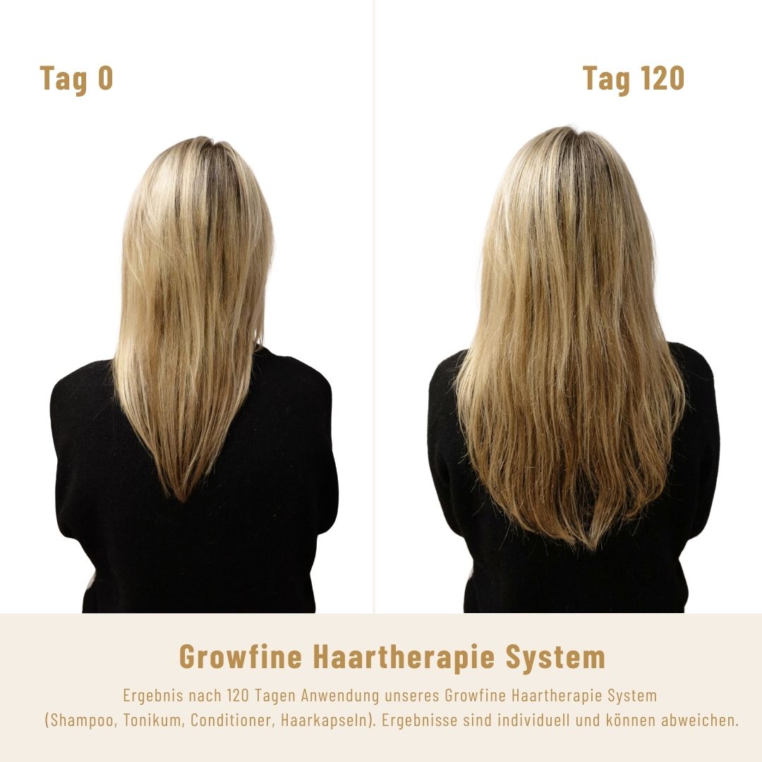Growfine Haartherapie© Premium-Set (Innen & Außen)