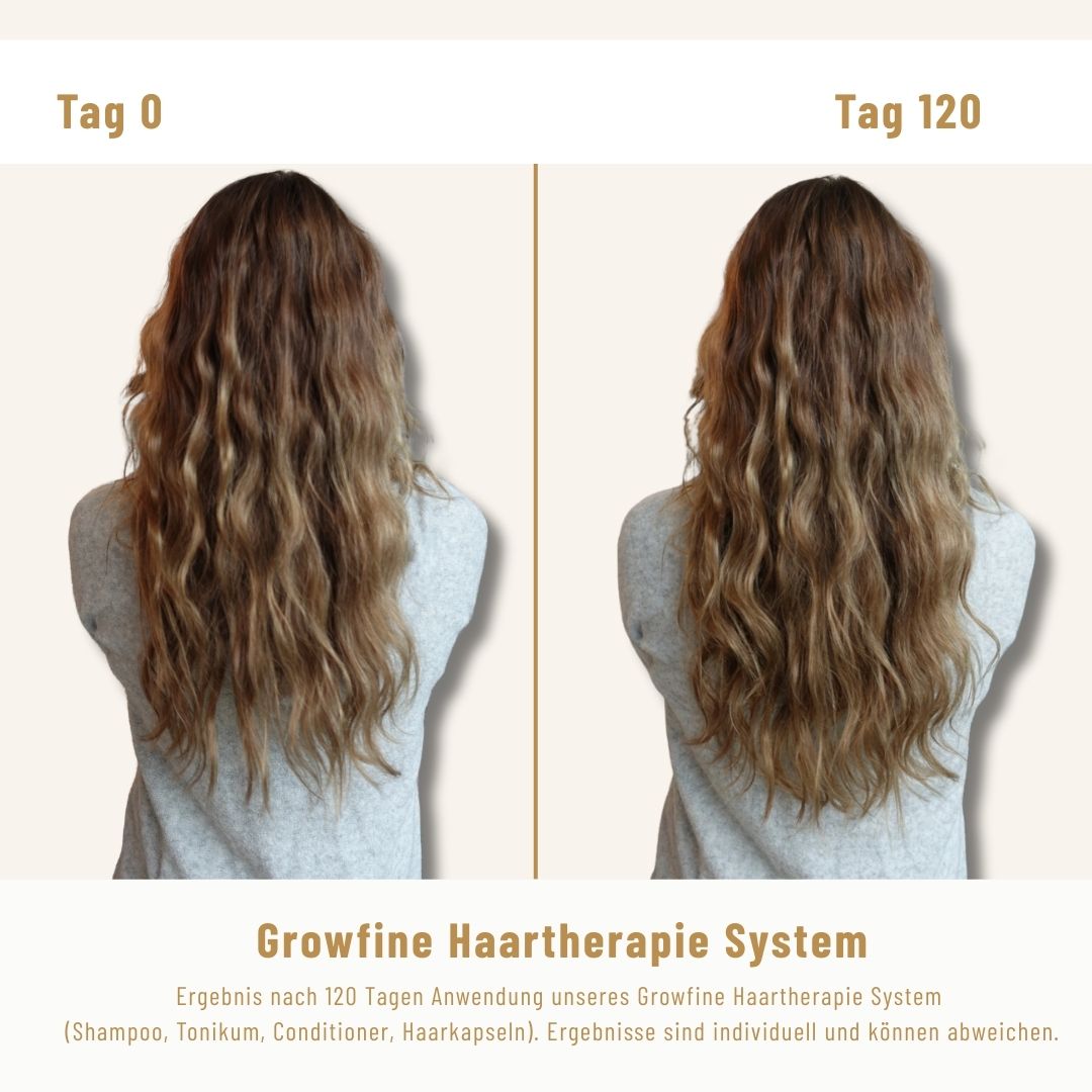 Kopfhaut-Aktiv-Shampoo