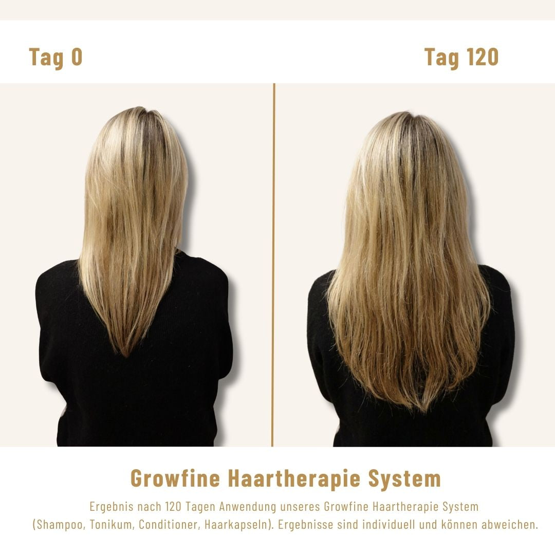 Growfine Haartherapie© Fokus-Set (Innen & Außen)