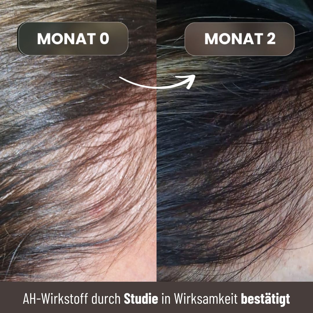 Growfine® Premium-Set für Pflege & stärkeres Wachstum