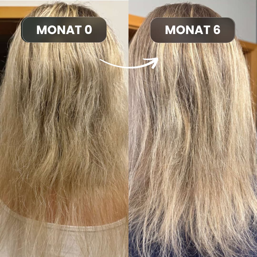 Shampoo gegen Haarausfall Vorher-Nacher