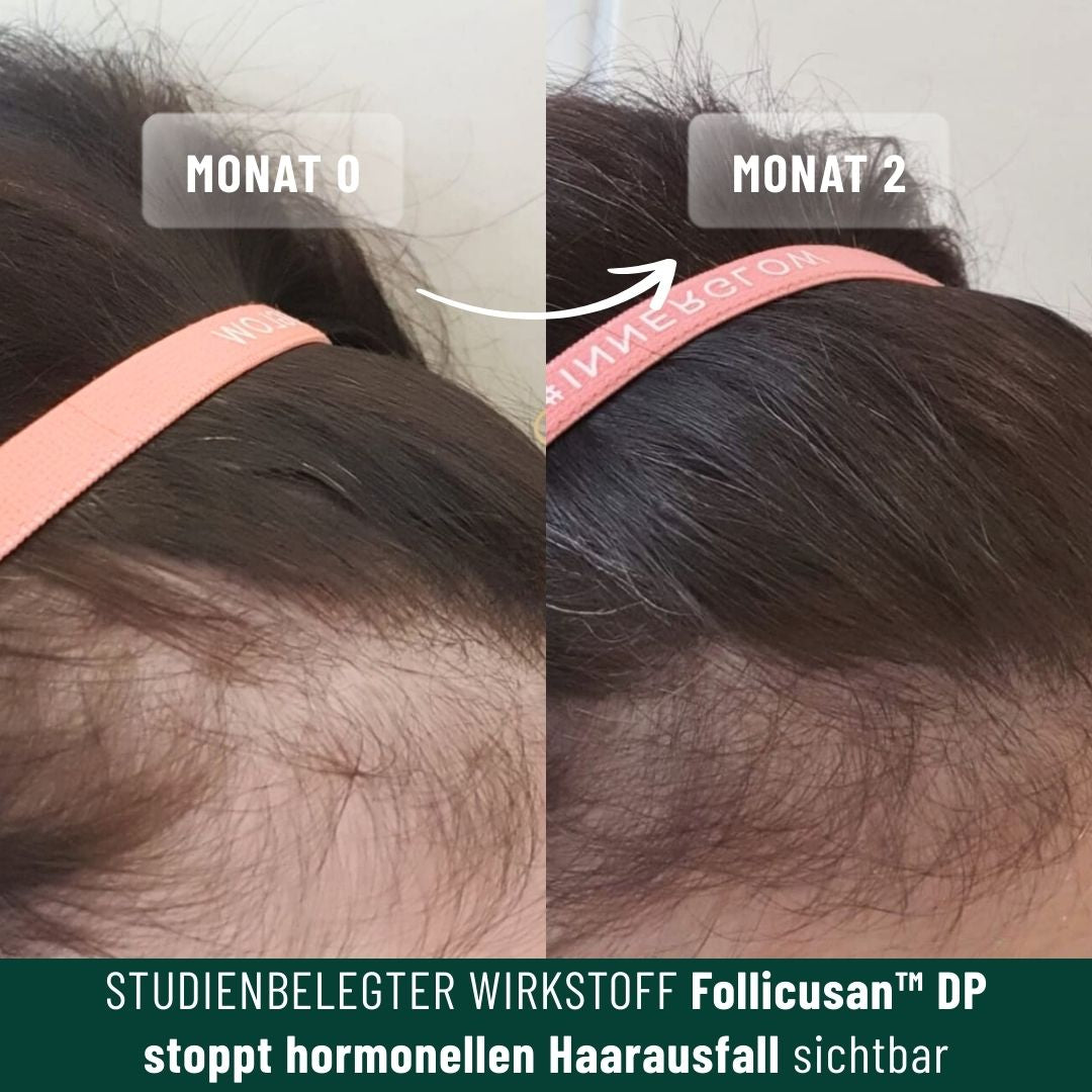 Vorteilsset: 3x Shampoo bei für feines Haar & Haarausfall