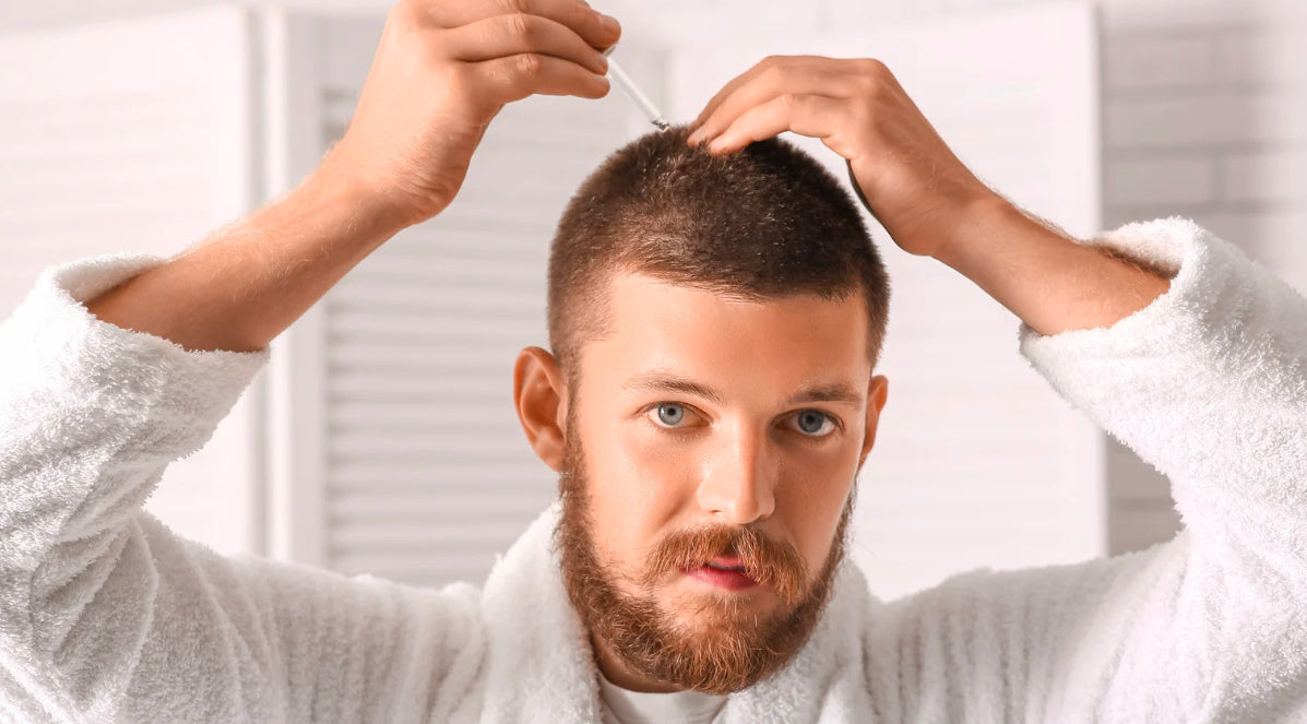 Wie erkennt man Haarausfall?