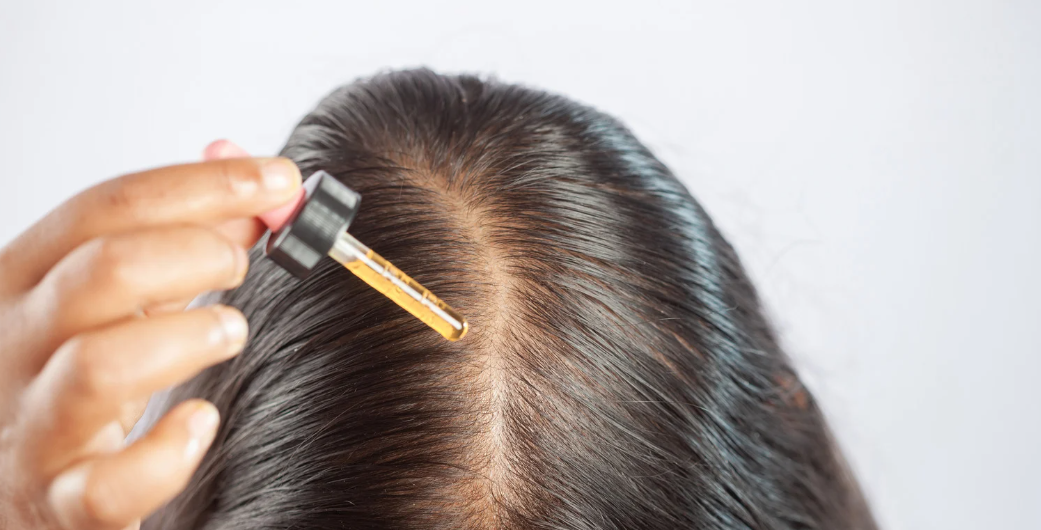 minoxidil nebenwirkungen