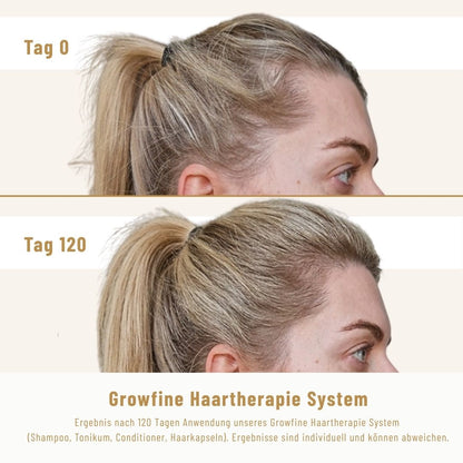 Growfine Haartherapie© Premium-Set (Innen &amp; Außen)