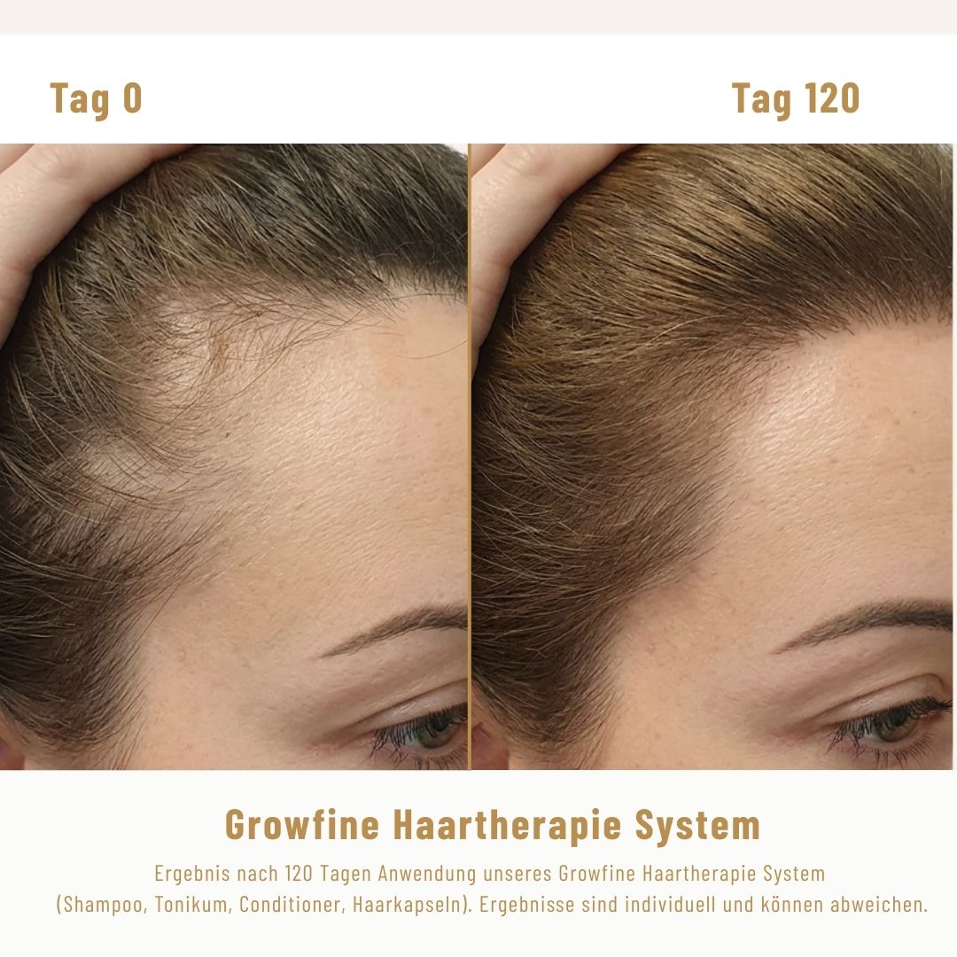 Growfine Haartherapie© Fokus-Set (Innen & Außen)