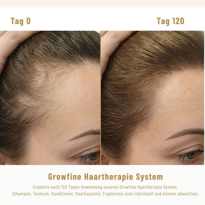 Growfine Haartherapie© Fokus-Set (Innen &amp; Außen)
