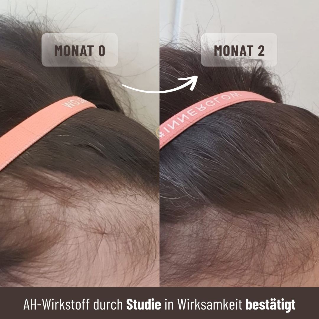 Growfine® Basis-Set für volleres Haar und stärkeres Wachstum