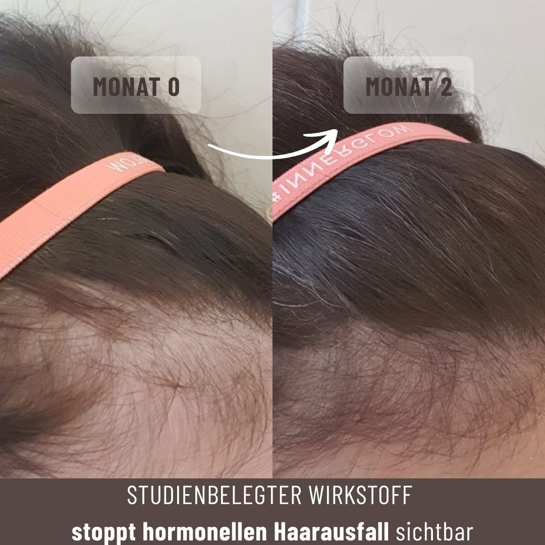 Growfine® Basis-Set für volleres Haar und stärkeres Wachstum