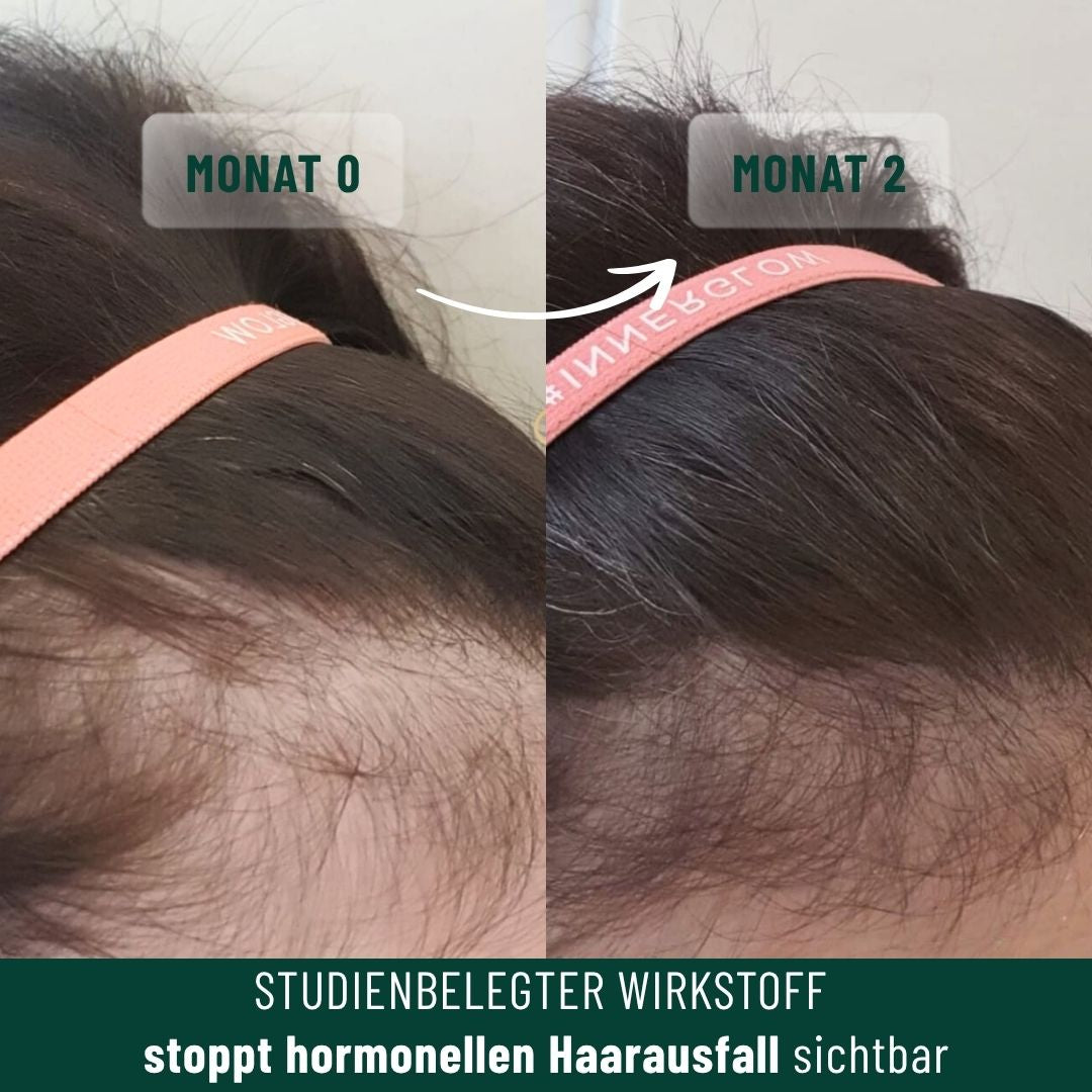 Growfine® Basis-Set für volleres Haar und stärkeres Wachstum