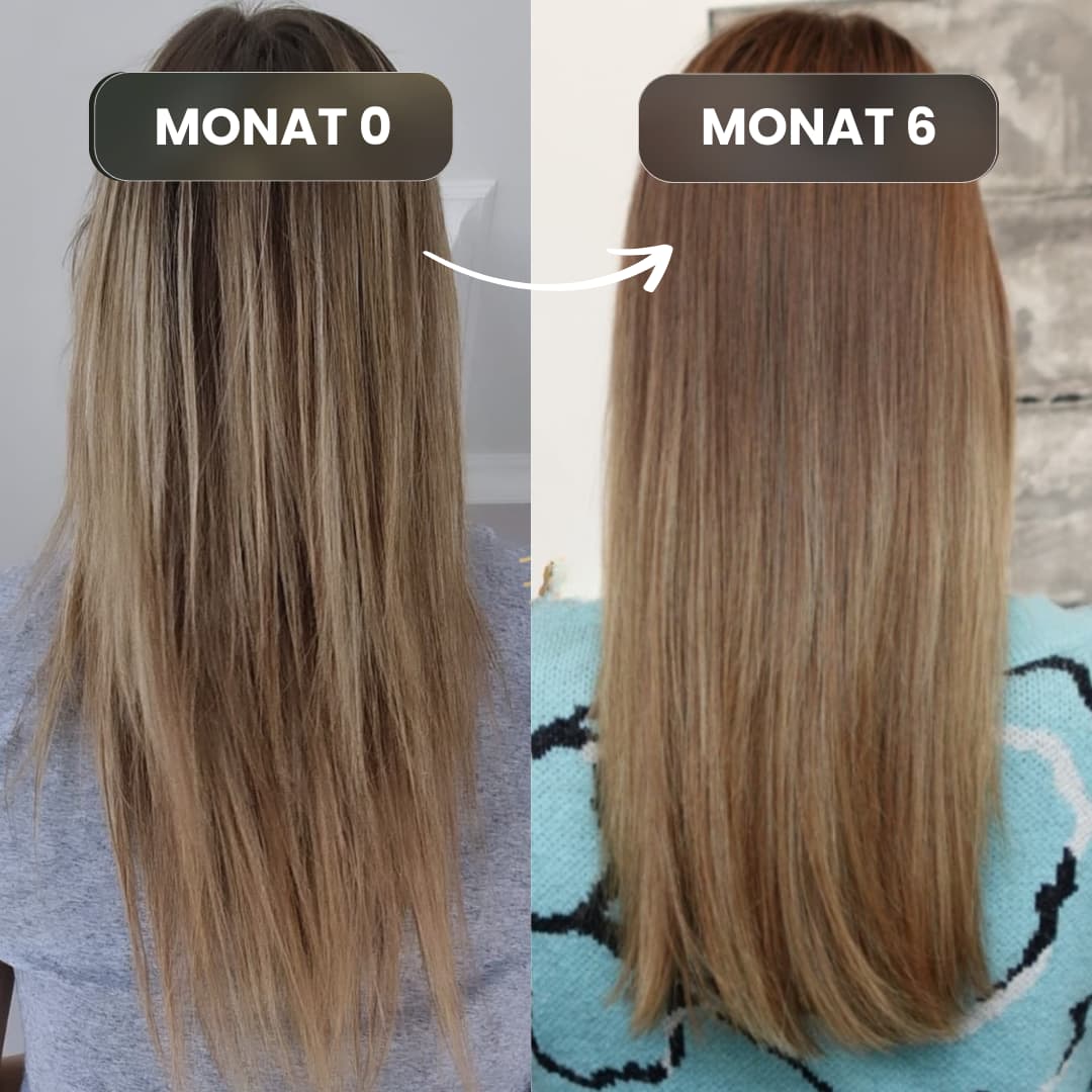 Shampoo gegen Haarausfall 
 Vorher-Nachher Vergleich