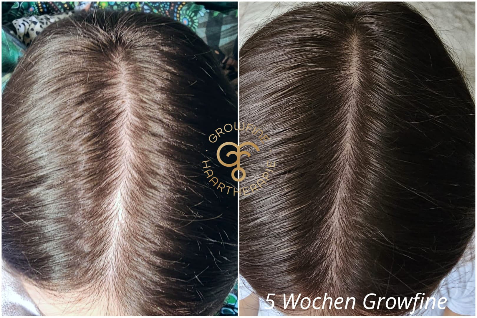 sägepalme haare vorher nacher