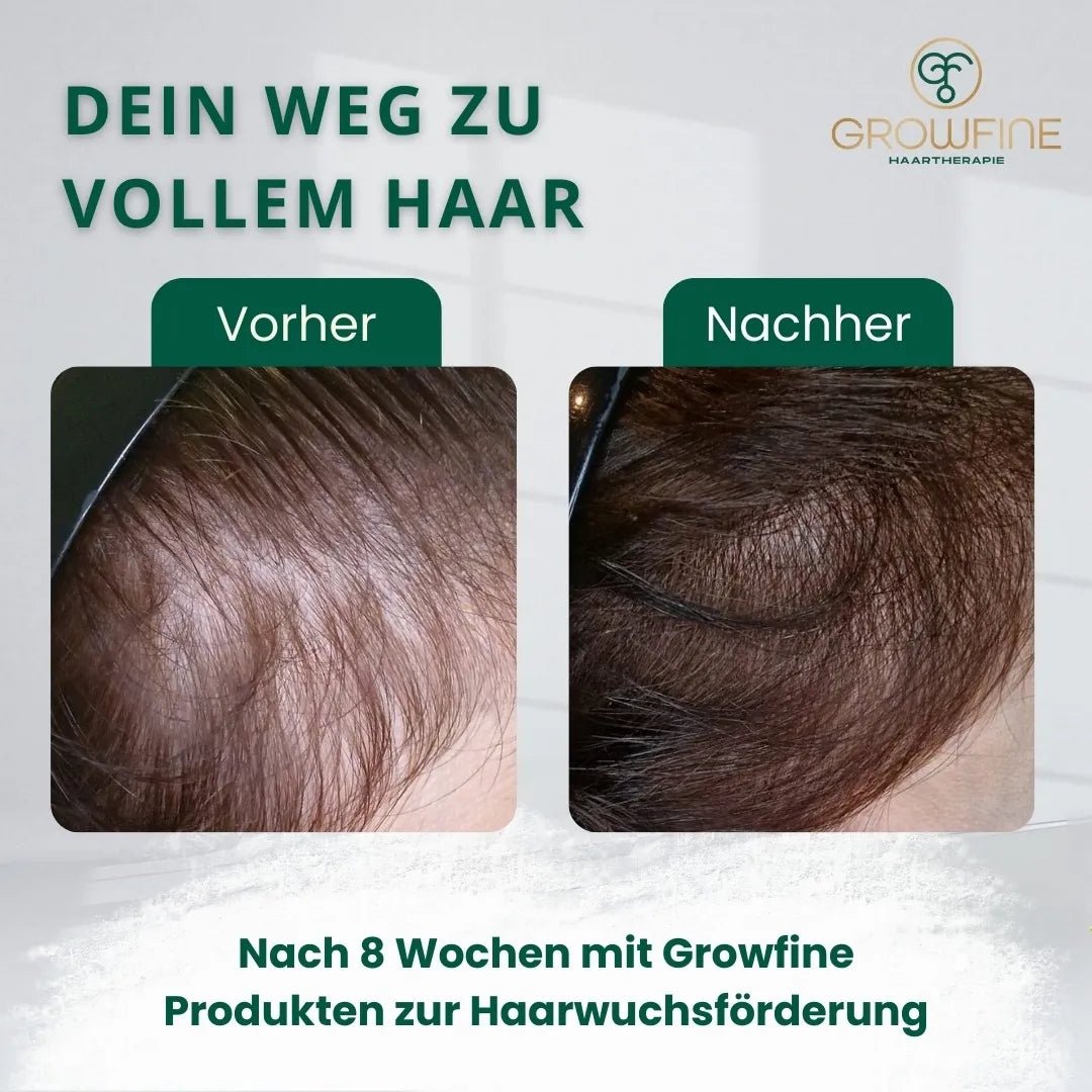 shampoo gegen haarausfall frauen