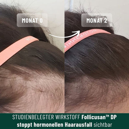 Vorteilsset: 3x Shampoo für feines Haar &amp; Haarausfall