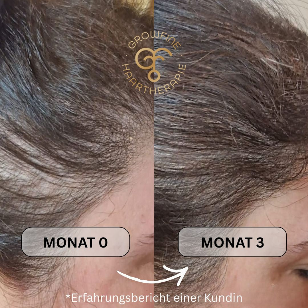 Pflege-Set für feines, strapaziertes Haar & Haarbruch